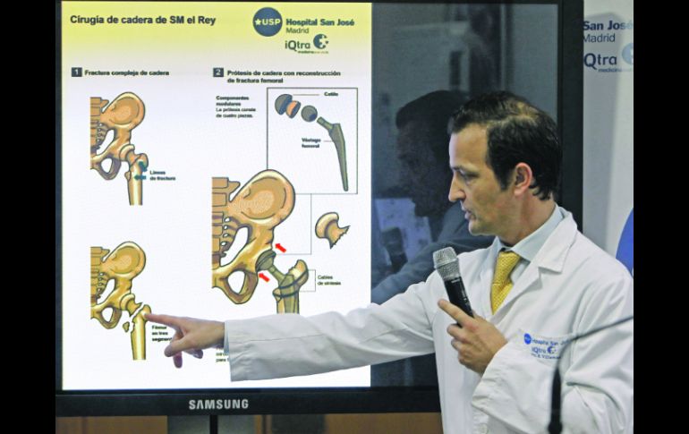 El médico Ángel Villamor explica los detalles de la cirugía practicada al rey Juan Carlos I de España. EFE  /