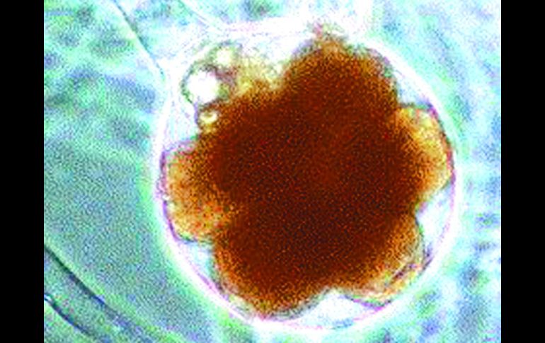 El microorganismo Serratia liquifaciens se halla en la piel humana. REUTERS /