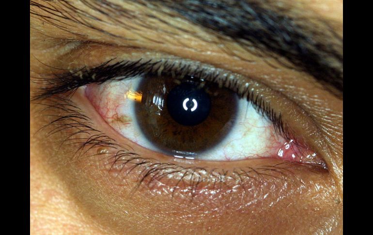 Este avance permitirá a médicos a miles de kilómetros ayudar a pacientes que sufren afecciones a la vista. ARCHIVO /