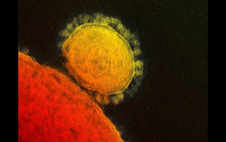 El MERS es un virus que ha dejado al menos 17 muertos, la mayoría en Arabia Saudita. ARCHIVO /