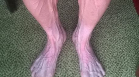 Las piernas de Bartosz Huzarski muestran como son exigidas en el Tour de France. ESPECIAL /