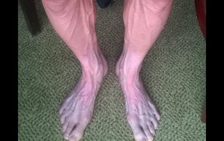 Las piernas de Bartosz Huzarski muestran como son exigidas en el Tour de France. ESPECIAL /