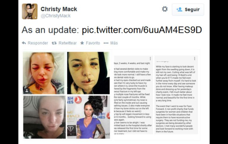 El rostro de Christy sólo requirió de pocas cirugías para reparar el daño que provocó el apodado 'War Machine'. TWITTER @ChristyMack  /