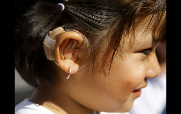 La tecnología auditiva que se desarrolla representaría un ahorro considerable para las personas con sordera genética. EL INFORMADOR / ARCHIVO