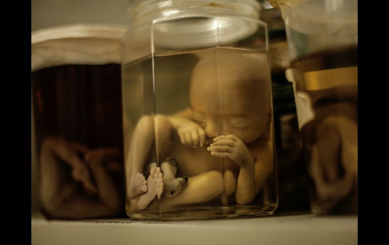La primera inyección de células embrionarias en fetos se realizará entre las semanas 20 y 34 del embarazo. EL INFORMADOR / ARCHIVO