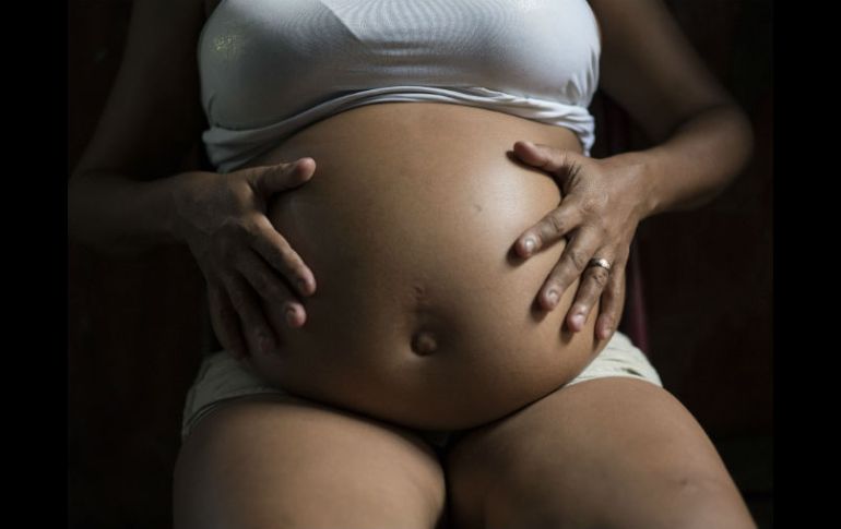 En Brasil, muchos niños cuyas madres tuvieron zika en los primeros meses de embarazo, nacieron con microcefalia. AP / F. Dana