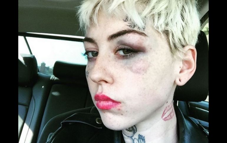 La artista dijo que fue golpeada en el rostro por un hombre que gritó 'Trump 2016'. INSTAGRAM / @illmagore