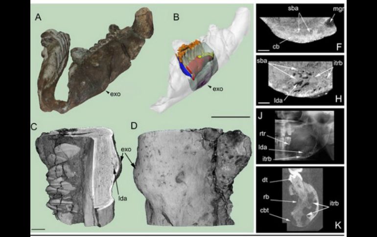 El tumor no canceroso es identificado en la mandíbula inferior de un Telmatosaurus transsylvanicus. ESPECIAL / www.nature.com